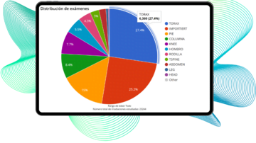 Estadisticas